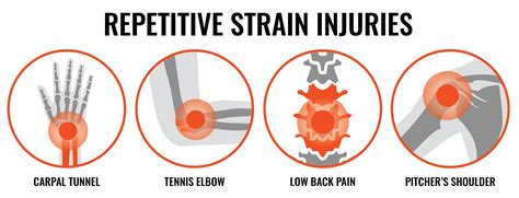 Repetitive Strain Injuries