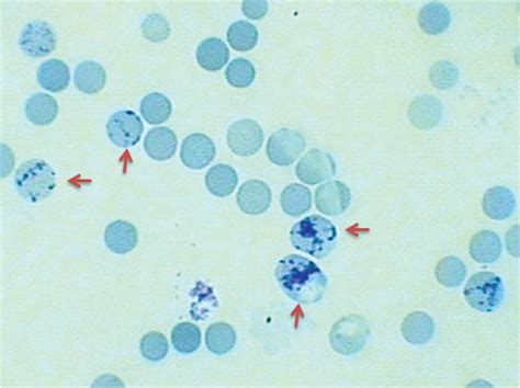 Reticular Site Count Mechanism