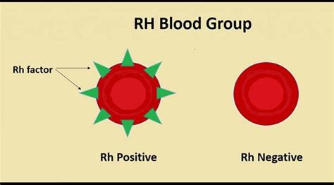 Rhesus Blood Group System and Transfusion Medicine