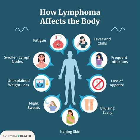 Risks And Complications Of Swollen Lymph Node