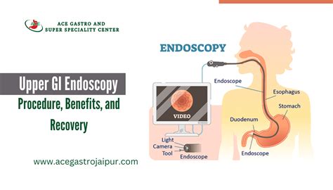 Risks and Complications of Upper GI Endoscopy Procedure