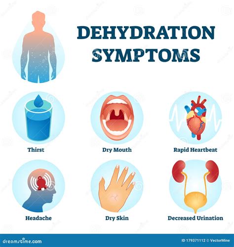 Severe Hydration Signs