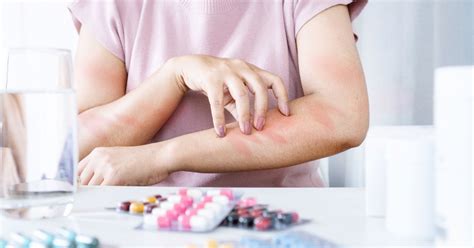 Side Effects Allergic Reactions