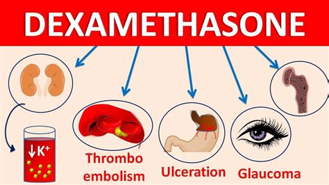 Side Effects and Precautions of Dexamethasone