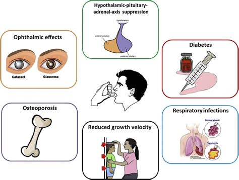 Side Effects of Inhaled Corticosteroids