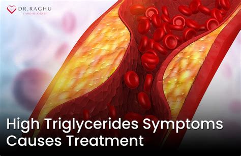 Signs of High Triglycerides