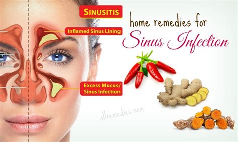 Sinus Infection Relief