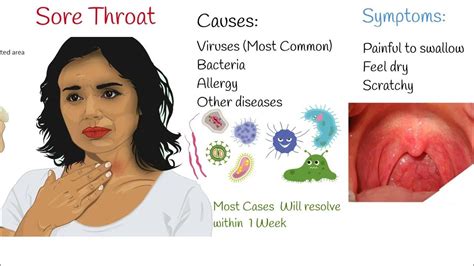 Sore Throat and Gastrointestinal Issues