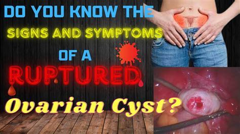 Symptoms and Complications