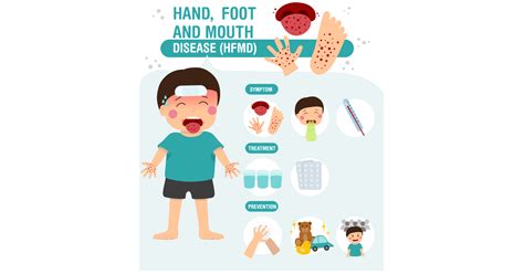 Symptoms of Hand Foot Mouth Disease