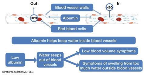 Symptoms of Low Albumin Levels