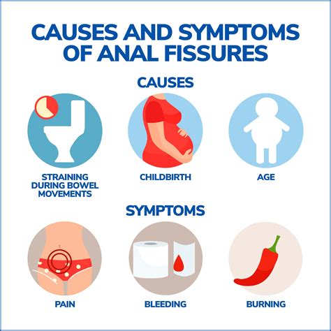 Symptoms of Rectal Fissures