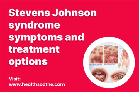Symptoms of Steven Johnson Syndrome
