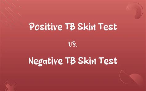 TB Skin Test Benefits