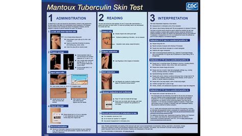 TB Test Results