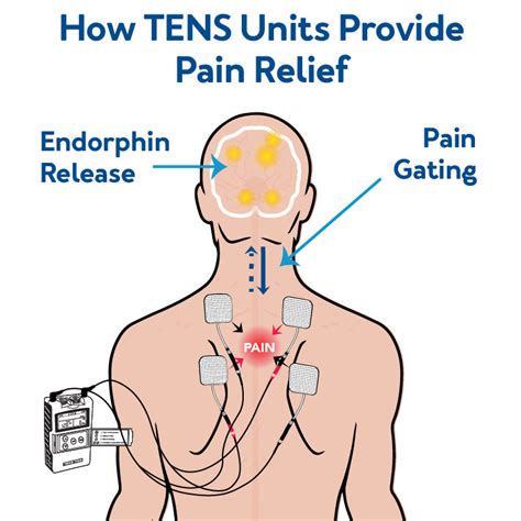 TENS Unit Mechanism