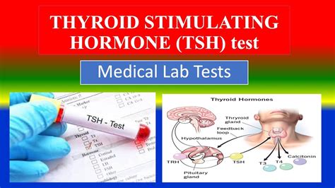 TSH Test Preparation and Procedure