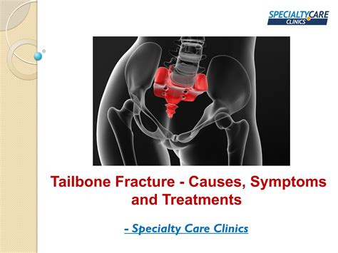 Tailbone Fracture Signs