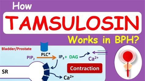 Tamsulosin Uses in BPH