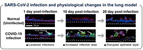 Technological Advances Respiratory Viruses