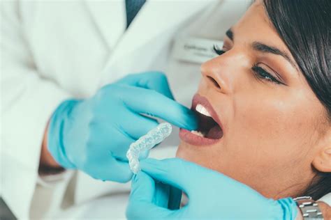 Teeth Bleaching By Dentist