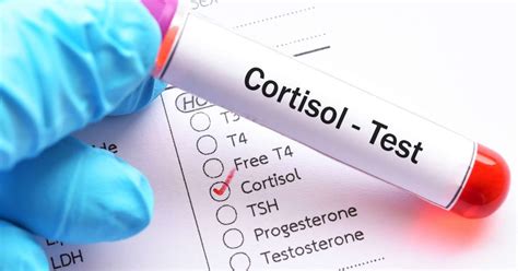 Testing Cortisol Levels