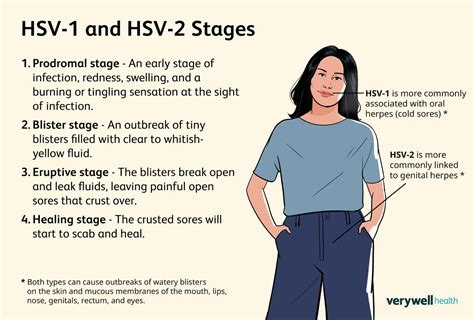Testing for HSV-1 and HSV-2
