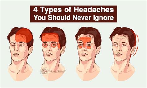 The Causes of Stress-Related Headaches