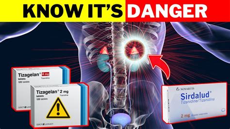 Tizanidine Side Effects