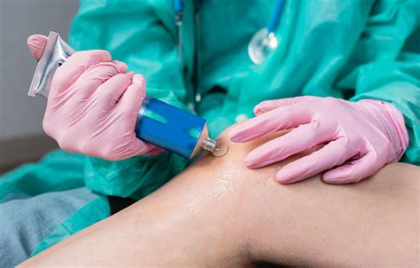 Topical treatments for second degree burn scars