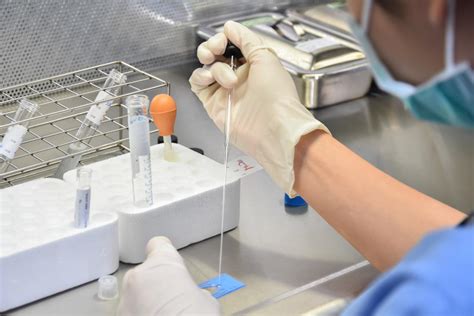 Traditional Laboratory Sperm Tests