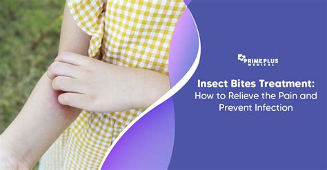 Treating Circular Bug Bites