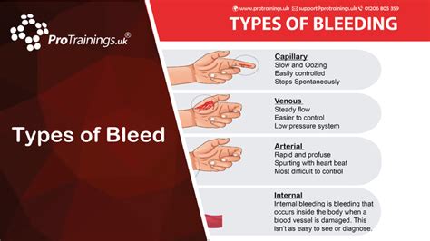 Treating Different Types of Bleeding