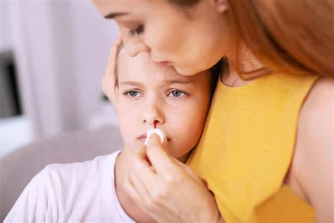 Treating Nosebleeds in Children