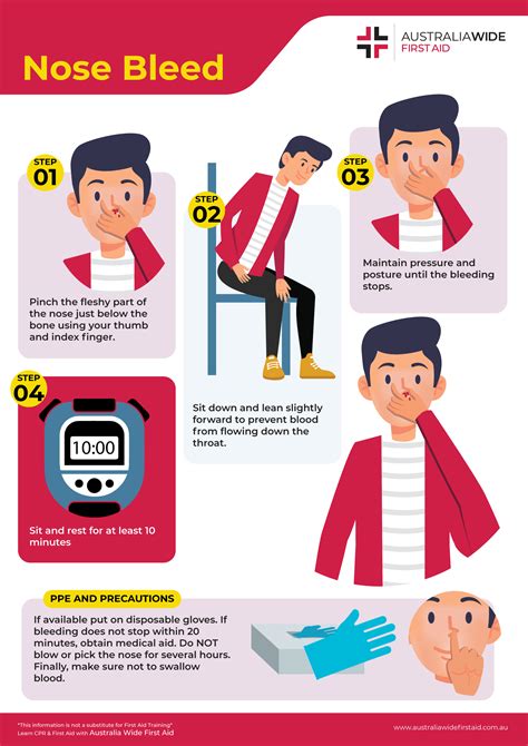 Treating Recurring Nosebleeds