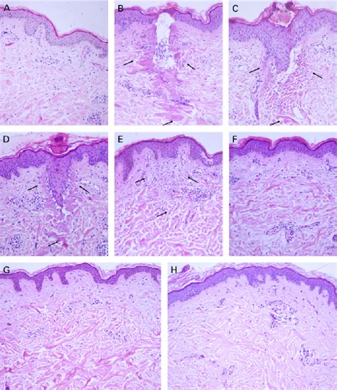 Treatment for Specific Populations
