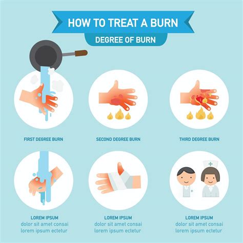 Treatment Methods For Burns