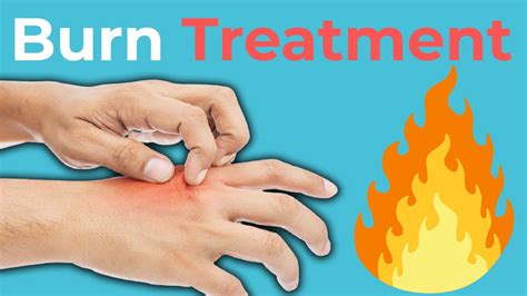 Treatment Options For Burns