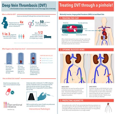 Treatment Options for Deep Thrombosis