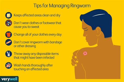Treatment Options for Ringworm