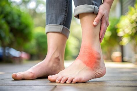 Treatment Options for Swollen Ankles During Pregnancy