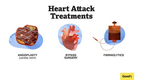 Treatment Strategies and Heart Attack Survival