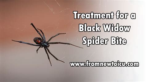 Treatment and Management of Black Widow Bites
