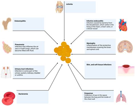 Treatment of Infections