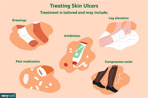Treatment of Ulcers