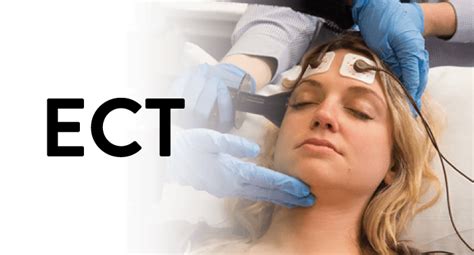 Types of ECT