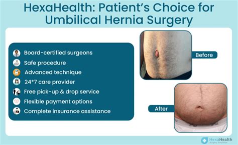 Umbilical Hernia Operation Costs and Insurance