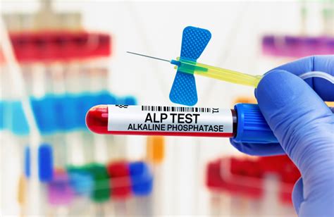 Understanding ALP Test Results