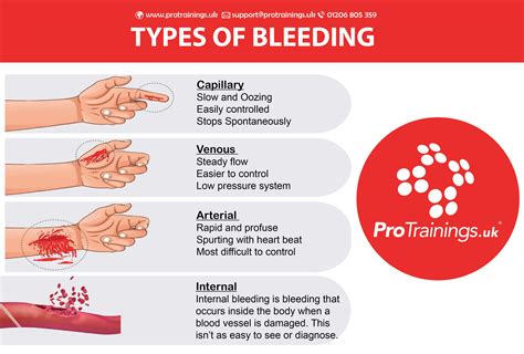 Understanding Bleeding