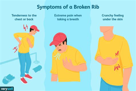 Understanding Broken Ribs